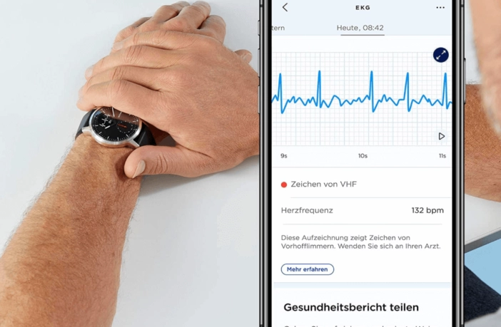 Withings Scanwatch